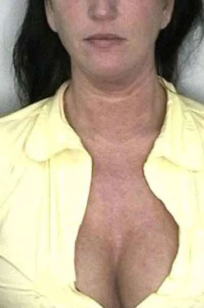 Nina Sørbråten